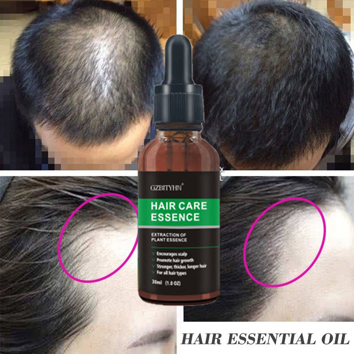 Hair Care Essential Oil