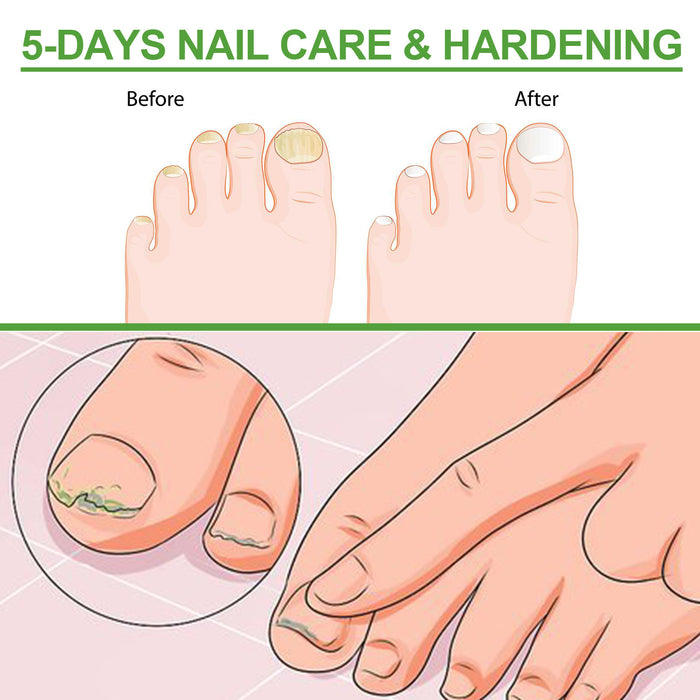 Nail Repair Roller